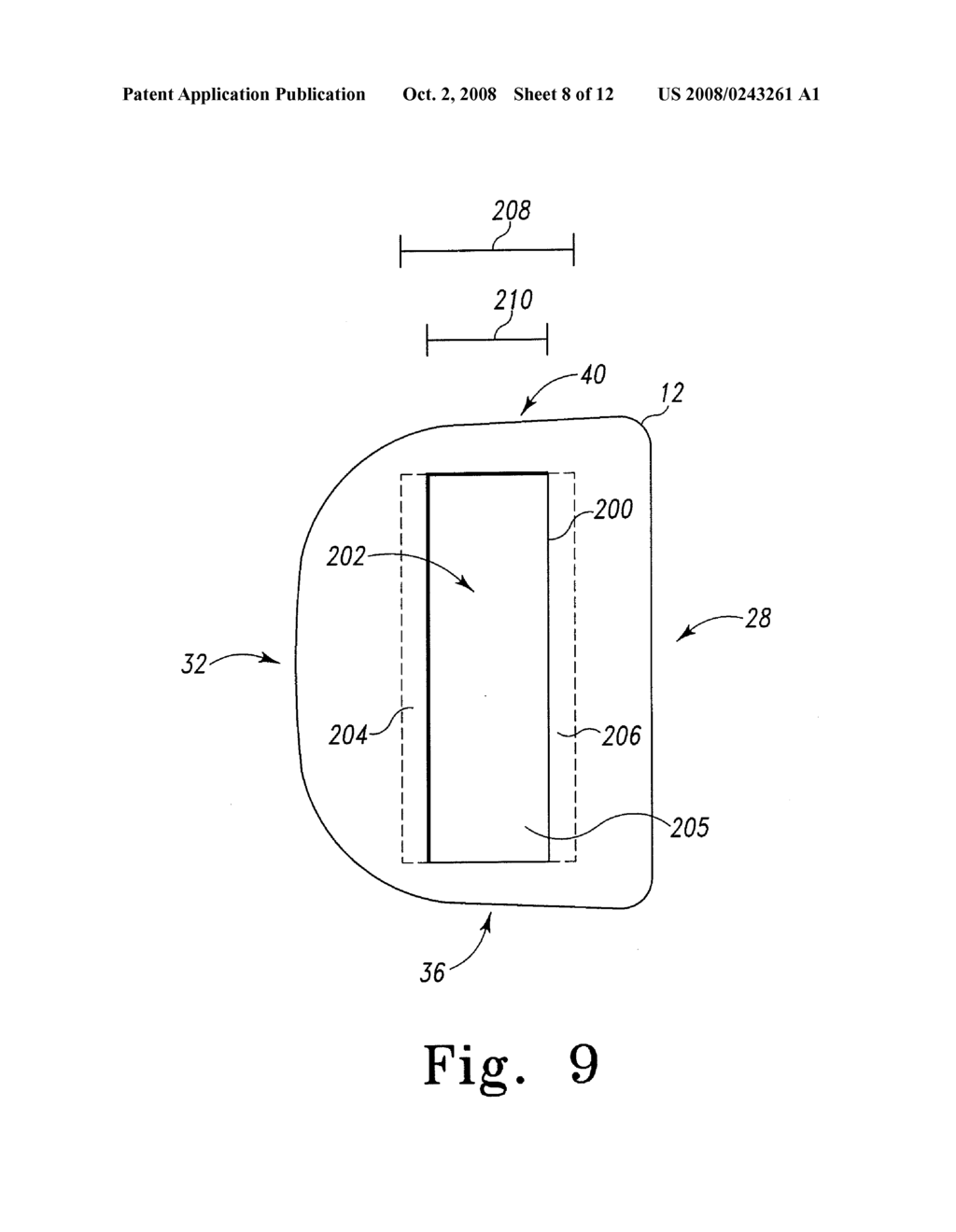 MOBILE BEARING ASSEMBLY HAVING A CLOSED TRACK - diagram, schematic, and image 09