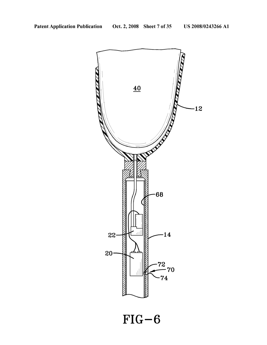 PROSTHETIC DEVICE UTILIZING ELECTRIC VACUUM PUMP - diagram, schematic, and image 08