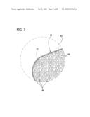 Compression Device with S-Shaped Bladder diagram and image