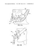 Patient Interface Device diagram and image