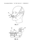 Patient Interface Device diagram and image