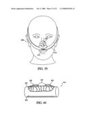 Patient Interface Device diagram and image