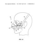 Patient Interface Device diagram and image