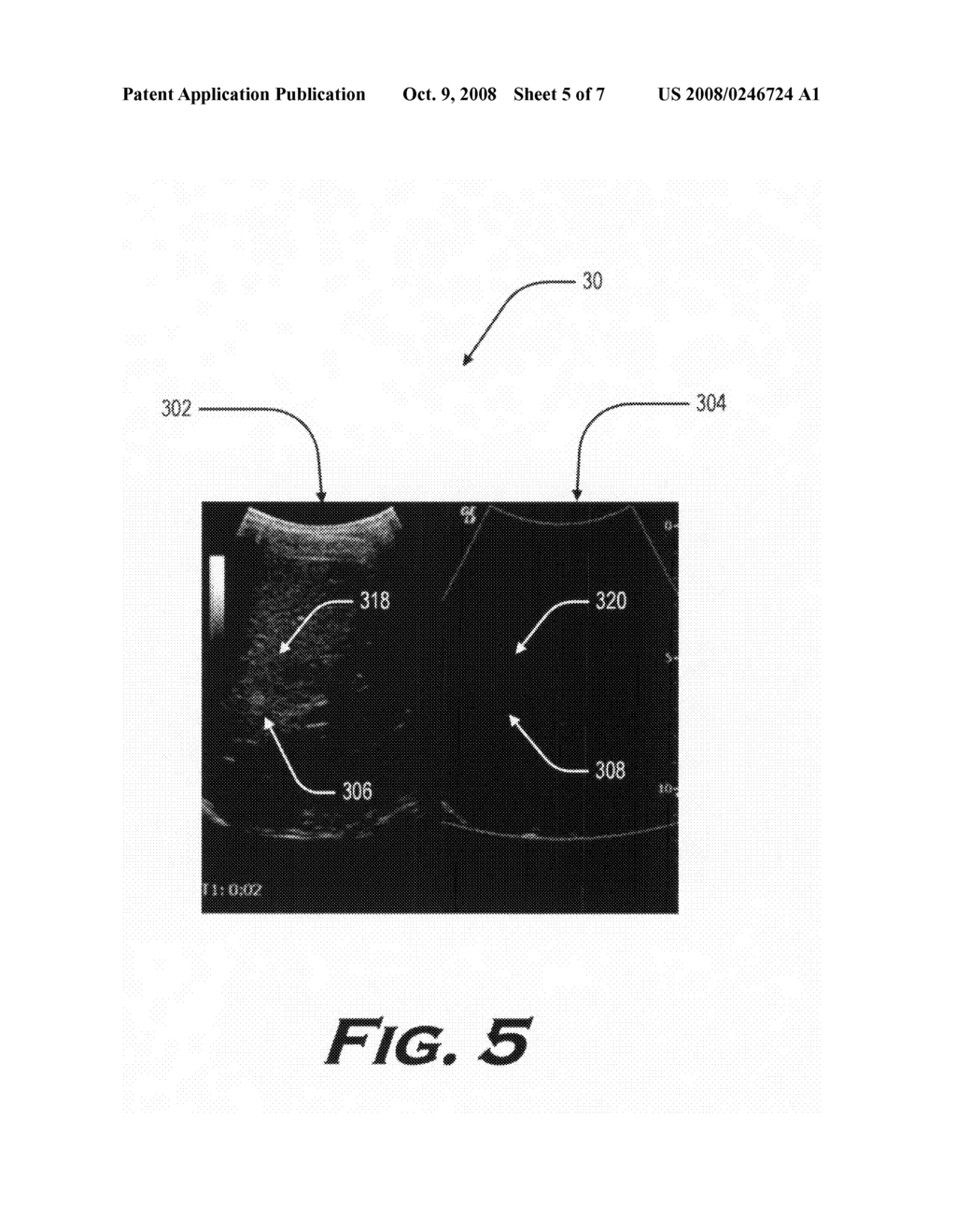 Method and apparatus for obtaining and/or analyzing anatomical images - diagram, schematic, and image 06