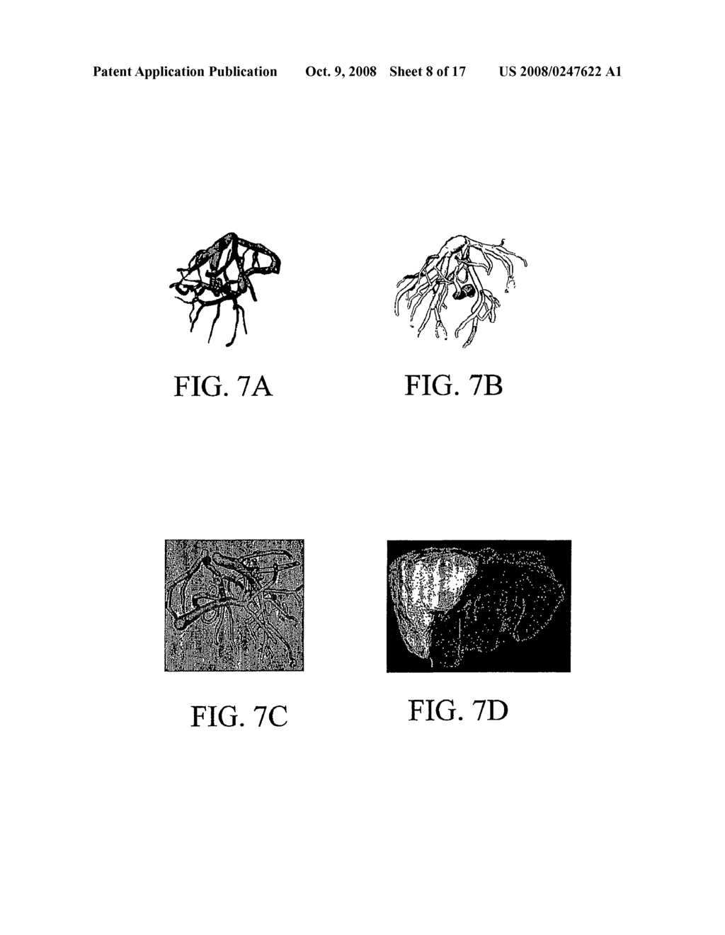 Methods, Systems, and Computer Program Products For Hierarchical Registration Between a Blood Vessel and Tissue Surface Model For a Subject and a Blood Vessel and Tissue Surface Image For the Subject - diagram, schematic, and image 09