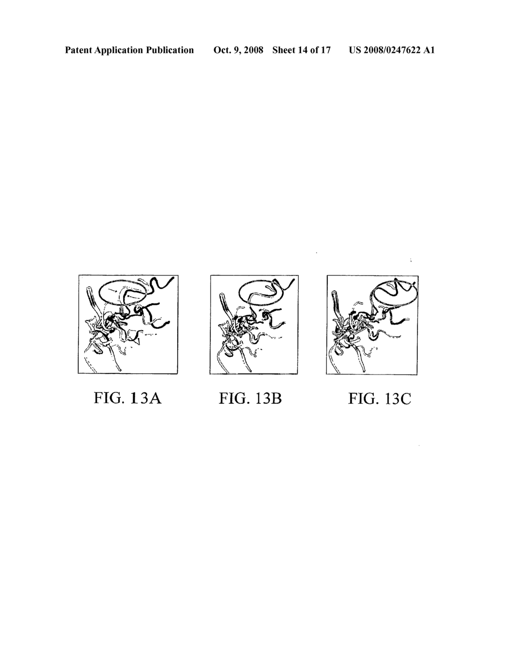 Methods, Systems, and Computer Program Products For Hierarchical Registration Between a Blood Vessel and Tissue Surface Model For a Subject and a Blood Vessel and Tissue Surface Image For the Subject - diagram, schematic, and image 15