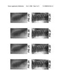 REGISTRATION METHOD FOR PROJECTIONS IN DUAL ENERGY diagram and image