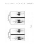 High dose 111In-pentetreotide therapy of neuroendocrine tumors diagram and image