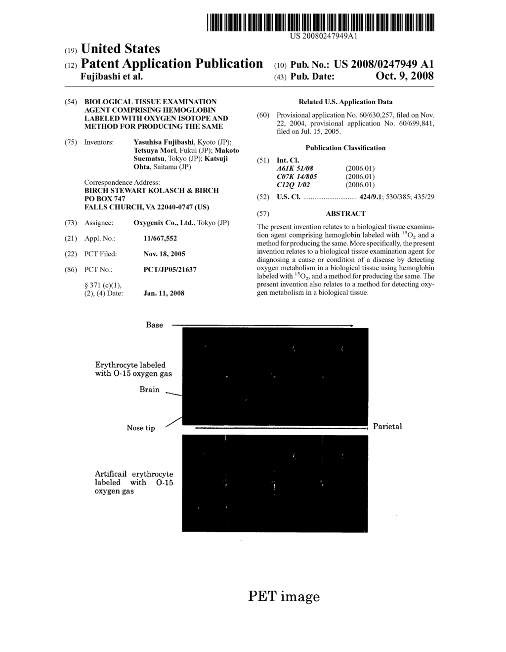 Biological Tissue Examination Agent Comprising Hemoglobin Labeled With Oxygen Isotope And Method For Producing The Same - diagram, schematic, and image 01