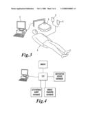 METHODS AND SYSTEMS FOR TREATING CELL PROLIFERATION DISORDERS diagram and image