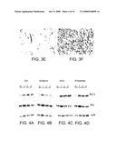 REGULATION OF ACHERON EXPRESSION diagram and image