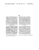 THERAPEUTIC AGENT FOR CANCER, INFLAMMATION, AND AUTO-IMMUNE DISEASE CONTAINING INHIBITOR OF ZINC FINGER PROTEIN 91 diagram and image