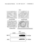 THERAPEUTIC AGENT FOR CANCER, INFLAMMATION, AND AUTO-IMMUNE DISEASE CONTAINING INHIBITOR OF ZINC FINGER PROTEIN 91 diagram and image