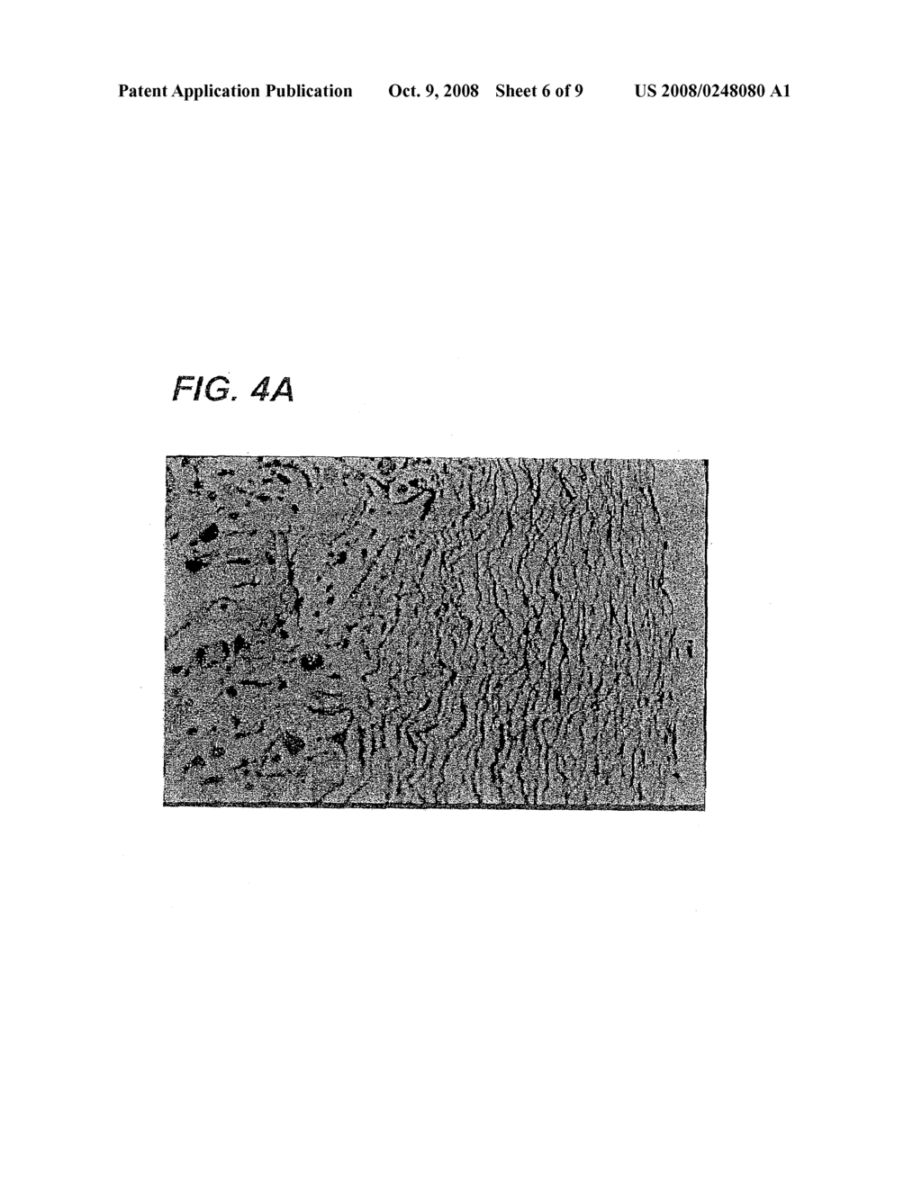 Decelluarlized Tissue Engineered Constructs and Tissues - diagram, schematic, and image 07