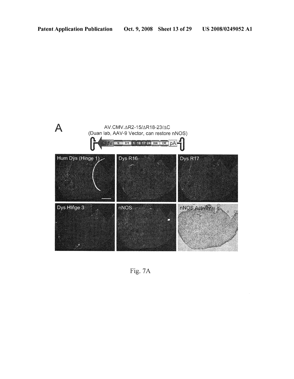 Synthetic mini/micro-dystrophin genes to restore nNOS to the sarcolemma - diagram, schematic, and image 14