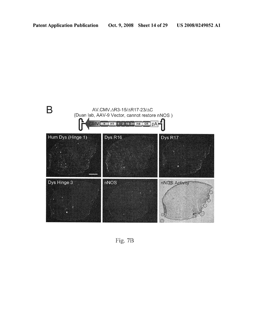 Synthetic mini/micro-dystrophin genes to restore nNOS to the sarcolemma - diagram, schematic, and image 15