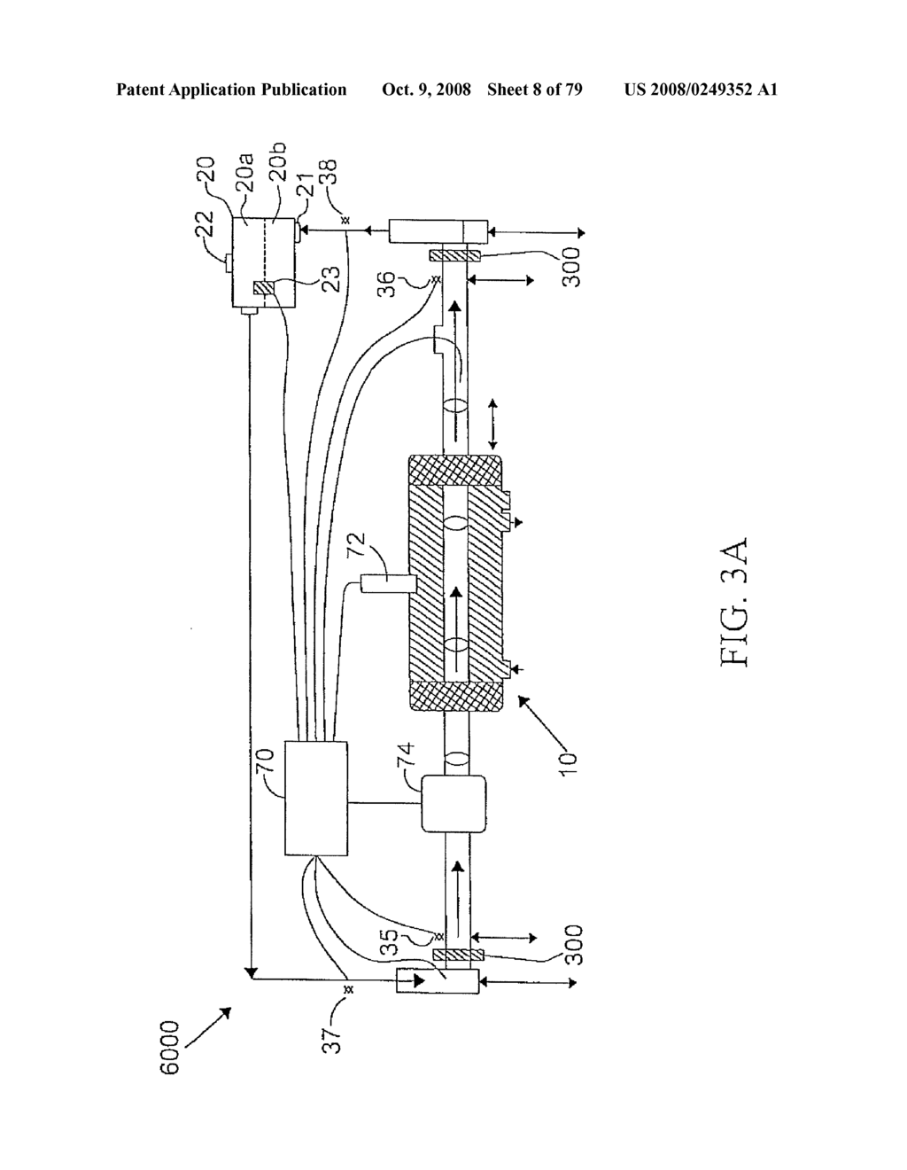 HYBRID CAROTID BYPASS GRAFTS AND SYSTEMS AND METHODS FOR PRODUCING OR MODIFYING THE SAME - diagram, schematic, and image 09