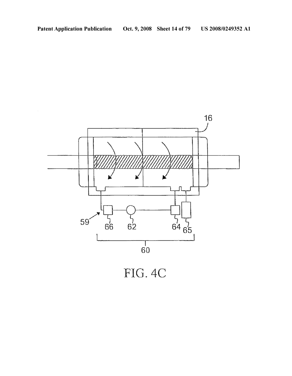 HYBRID CAROTID BYPASS GRAFTS AND SYSTEMS AND METHODS FOR PRODUCING OR MODIFYING THE SAME - diagram, schematic, and image 15