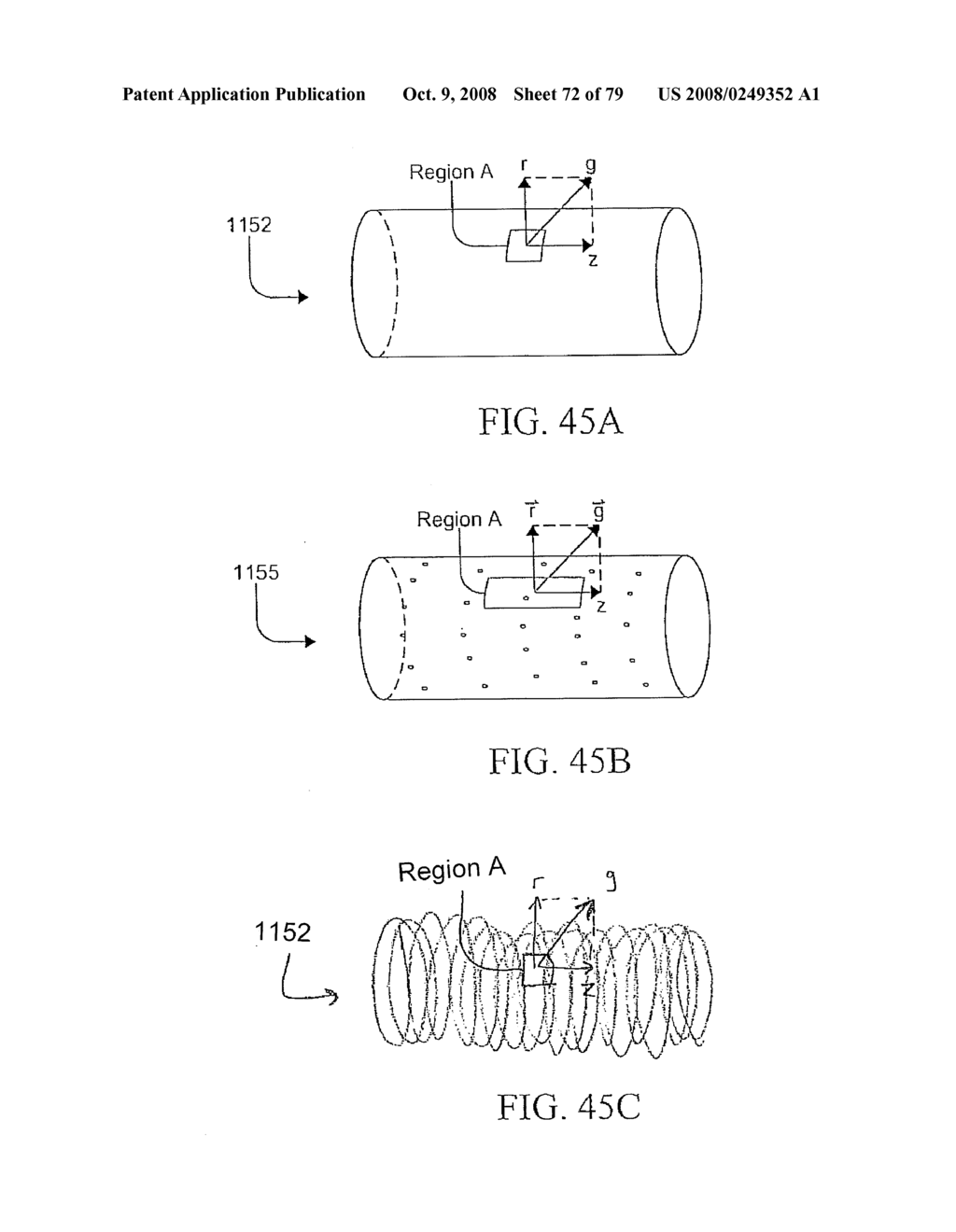 HYBRID CAROTID BYPASS GRAFTS AND SYSTEMS AND METHODS FOR PRODUCING OR MODIFYING THE SAME - diagram, schematic, and image 73