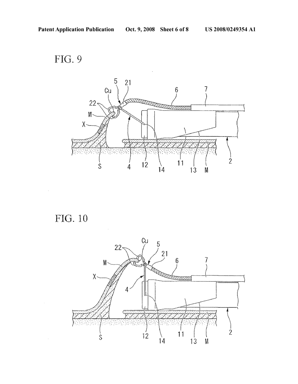 ENDOSCOPE TREATMENT TOOL - diagram, schematic, and image 07