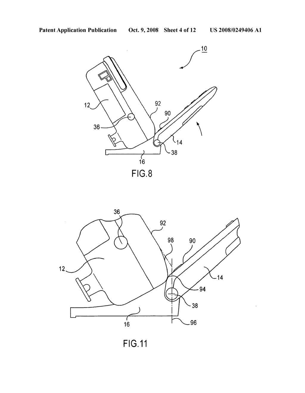 ULTRASOUND DIAGNOSTIC APPARATUS - diagram, schematic, and image 05