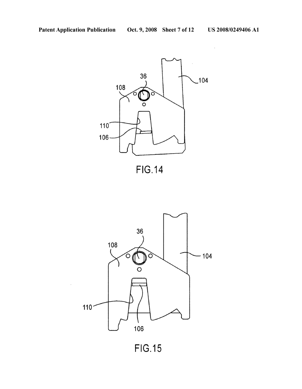 ULTRASOUND DIAGNOSTIC APPARATUS - diagram, schematic, and image 08