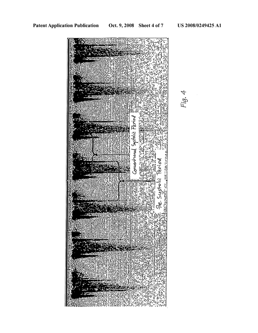 Method and Apparatus for Defining Cardiac Time Intervals - diagram, schematic, and image 05