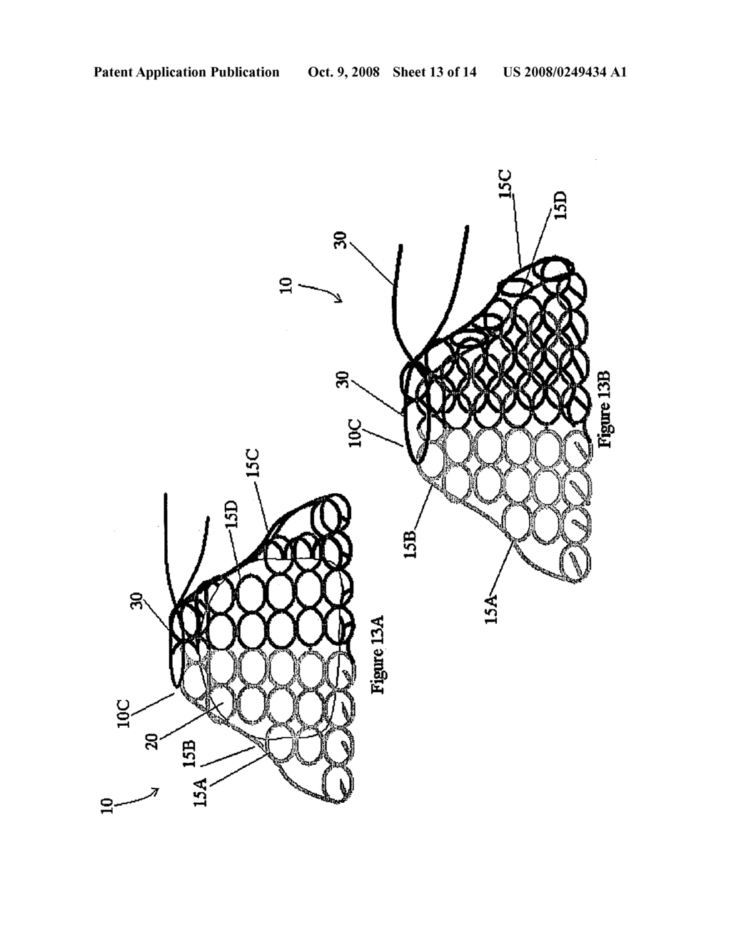 Device and Method for Transporting and Handling Tissue - diagram, schematic, and image 14