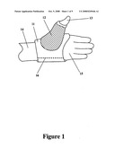 Low-temperature reusable thermoplastic splint diagram and image