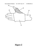 Low-temperature reusable thermoplastic splint diagram and image