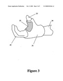 Low-temperature reusable thermoplastic splint diagram and image