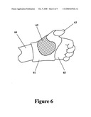 Low-temperature reusable thermoplastic splint diagram and image