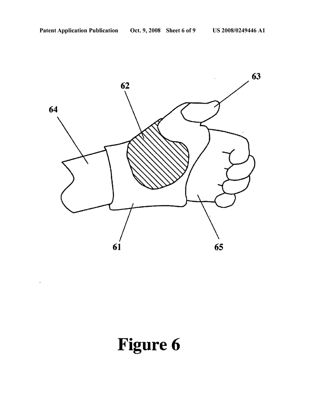 Low-temperature reusable thermoplastic splint - diagram, schematic, and image 07