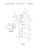 CABLE-BASED ORTHOPEDIC BRACING SYSTEM diagram and image