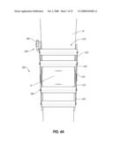 CABLE-BASED ORTHOPEDIC BRACING SYSTEM diagram and image