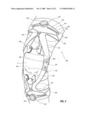 CABLE-BASED ORTHOPEDIC BRACING SYSTEM diagram and image