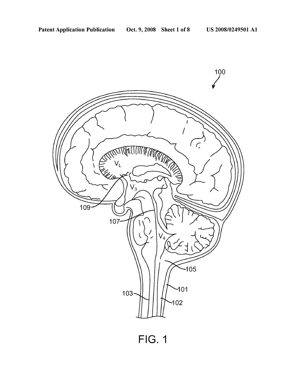 Methods for Simultaneous Injection and Aspiration of Fluids During a Medical Procedure - diagram, schematic, and image 02