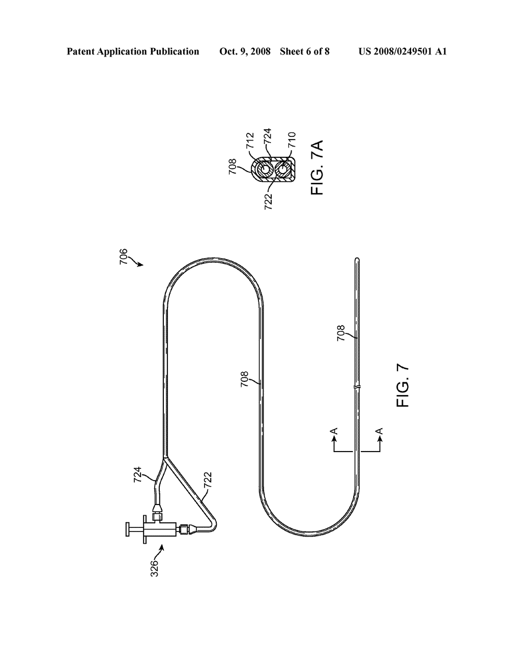 Methods for Simultaneous Injection and Aspiration of Fluids During a Medical Procedure - diagram, schematic, and image 07