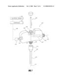 BONE TREATMENT SYSTEMS AND METHODS diagram and image