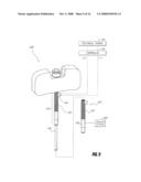 BONE TREATMENT SYSTEMS AND METHODS diagram and image