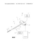 BONE TREATMENT SYSTEMS AND METHODS diagram and image