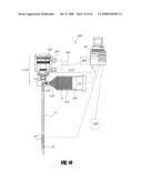 BONE TREATMENT SYSTEMS AND METHODS diagram and image