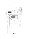 BONE TREATMENT SYSTEMS AND METHODS diagram and image