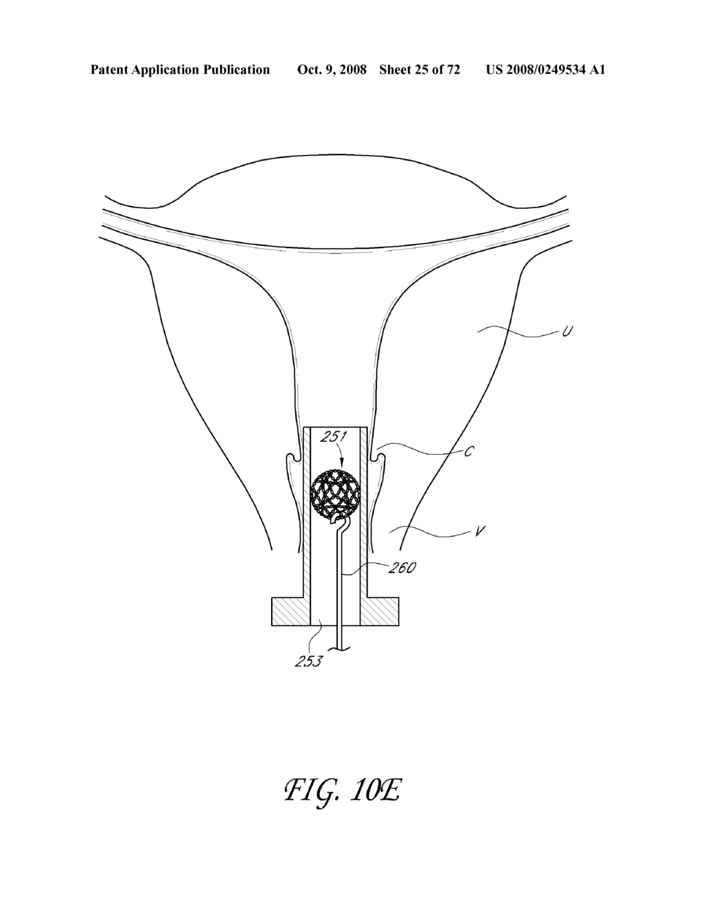 METHOD AND DEVICE FOR DISTENDING A GYNECOLOGICAL CAVITY - diagram, schematic, and image 26