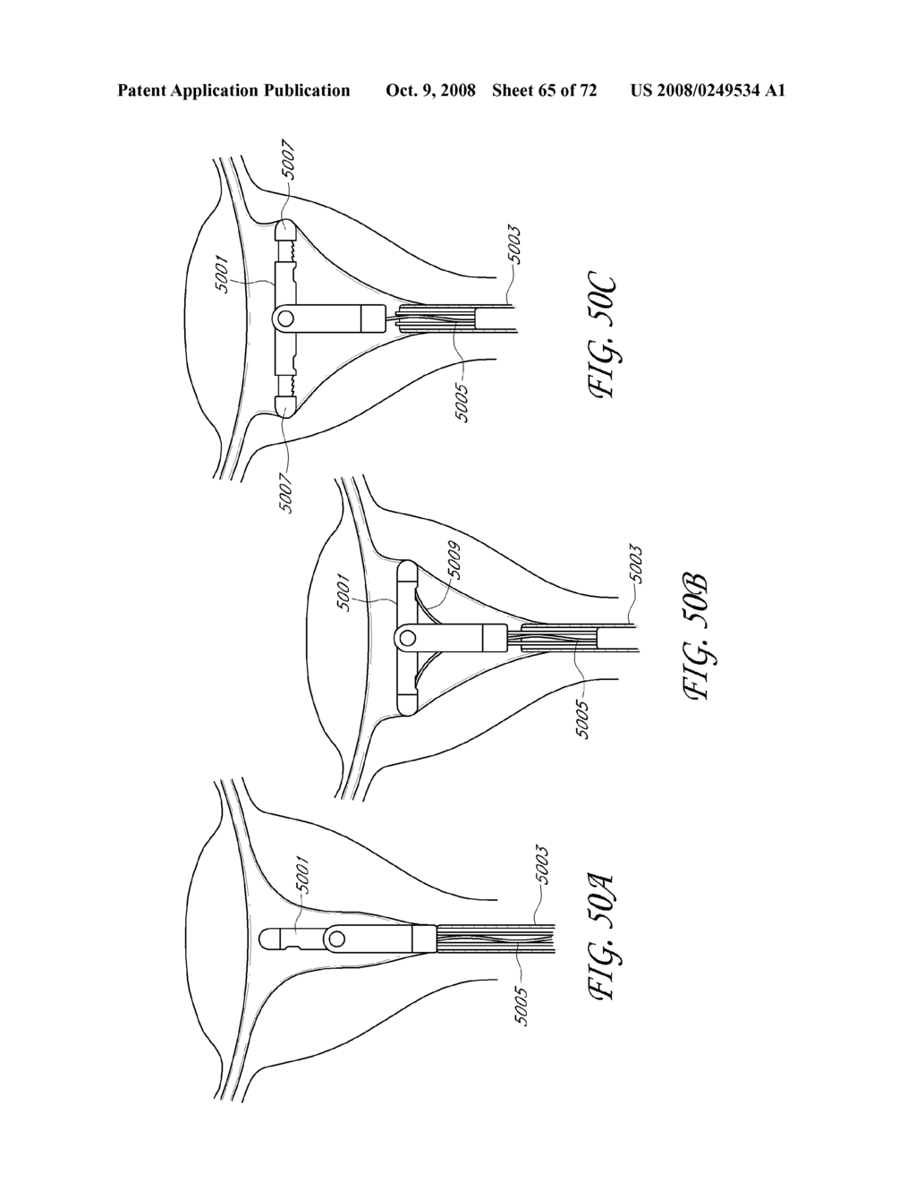 METHOD AND DEVICE FOR DISTENDING A GYNECOLOGICAL CAVITY - diagram, schematic, and image 66