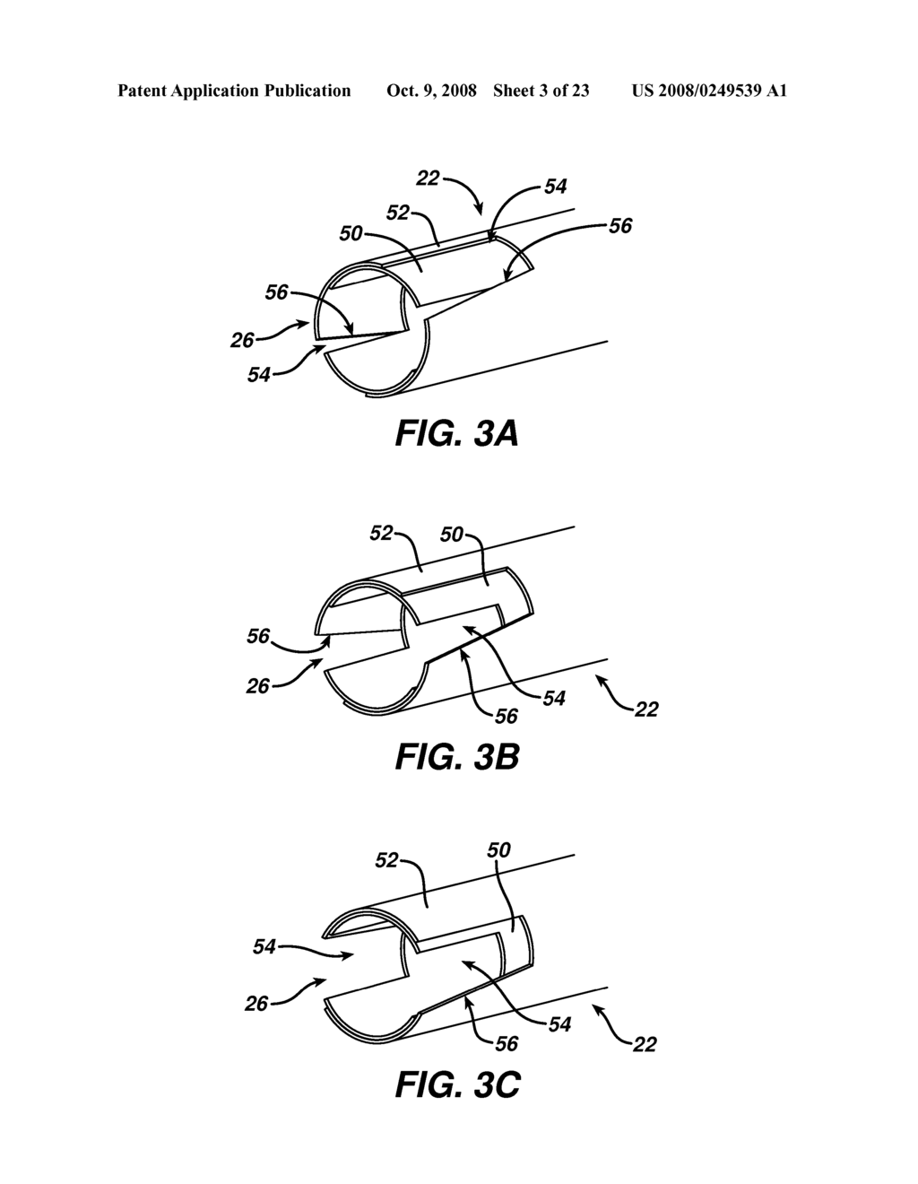 DEVICE FOR PLICATING AND FASTENING GASTRIC TISSUE - diagram, schematic, and image 04