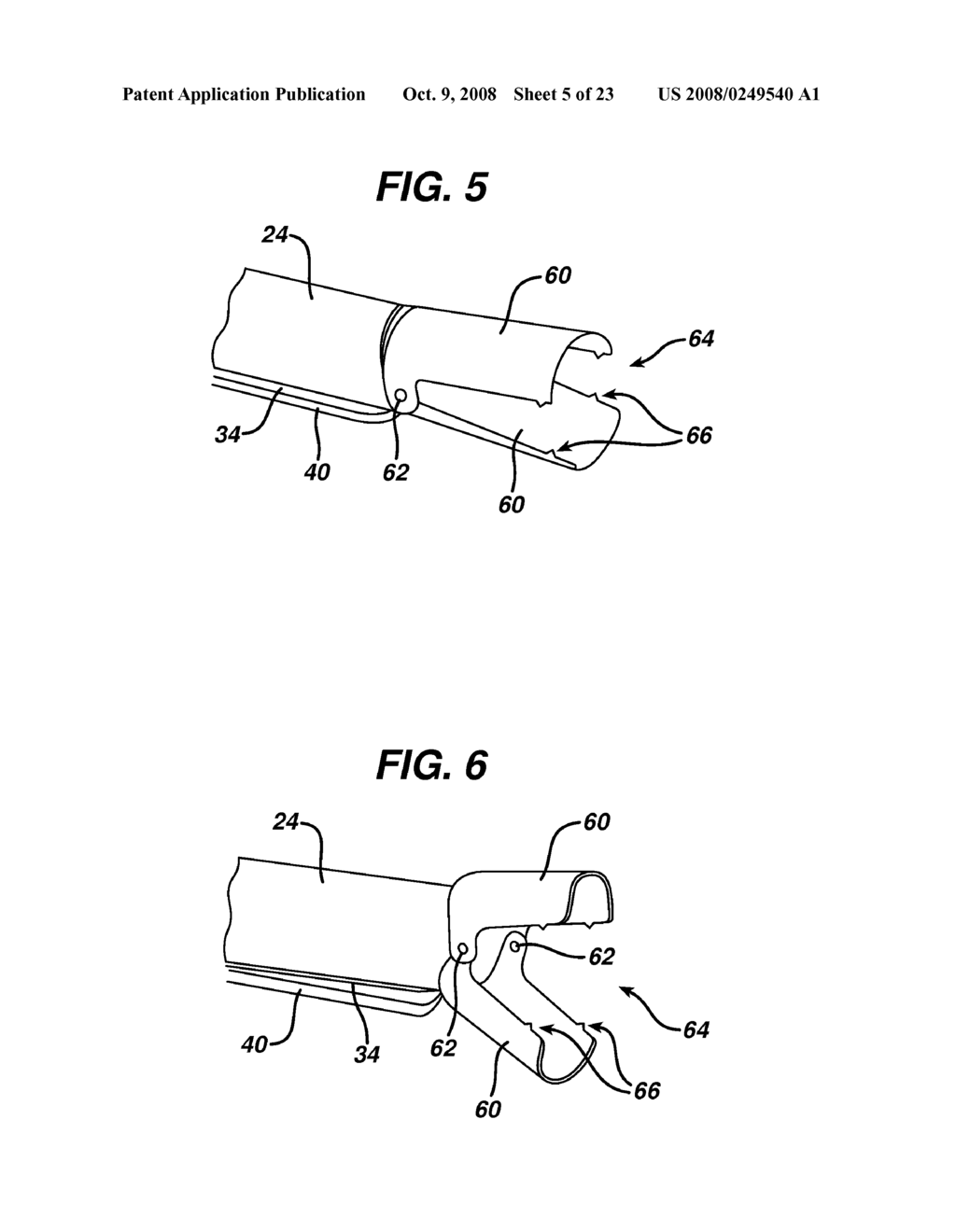 METHOD FOR PLICATING AND FASTENING GASTRIC TISSUE - diagram, schematic, and image 06