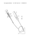 SUTURING, CRIMPING AND CUTTING DEVICE diagram and image