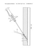 SUTURING, CRIMPING AND CUTTING DEVICE diagram and image