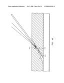 SUTURING, CRIMPING AND CUTTING DEVICE diagram and image